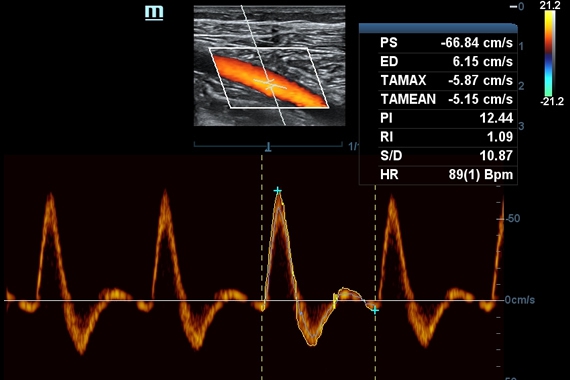 Mindray DC-70 pro X-Insight
