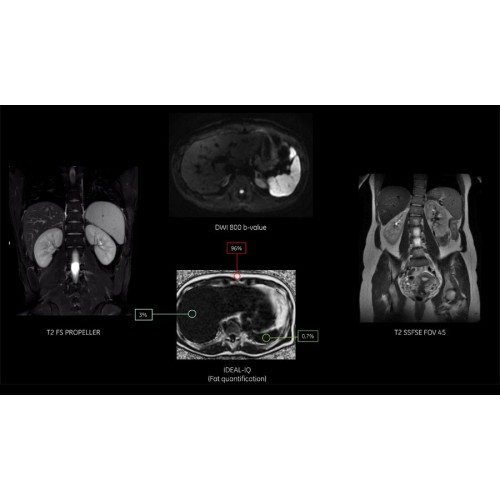 МРТ аппарат GE SIGNA Pioneer 3.0T