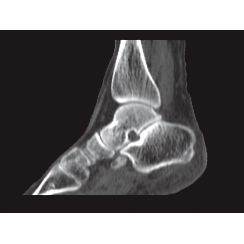 КТ аппарат GE Brivo CT385